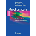 Onychomycosis: An Illustrated Guide to Diagnosis and Treatment