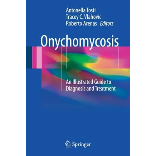 Onychomycosis: An Illustrated Guide to Diagnosis and Treatment