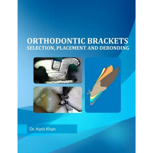 Orthodontic Brackets: Selection, Placement and Debonding