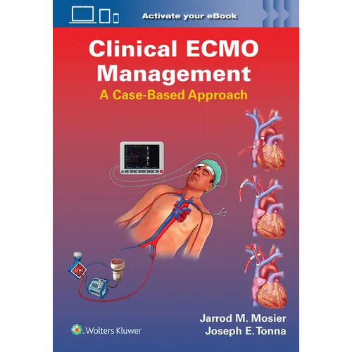 Clinical Ecmo Management: A Case-Based Approach