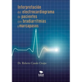 Interpretación del electrocardiograma de pacientes con bradiarritmias y marcapasos