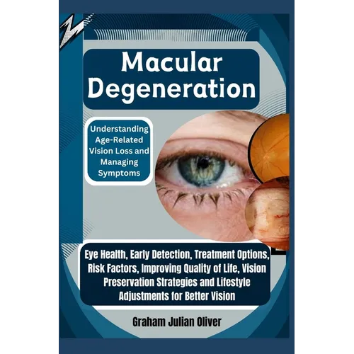 Macular Degeneration: Understanding Age-Related Vision Loss and Managing Symptoms: Eye Health, Early Detection, Treatment Options, Risk Fact