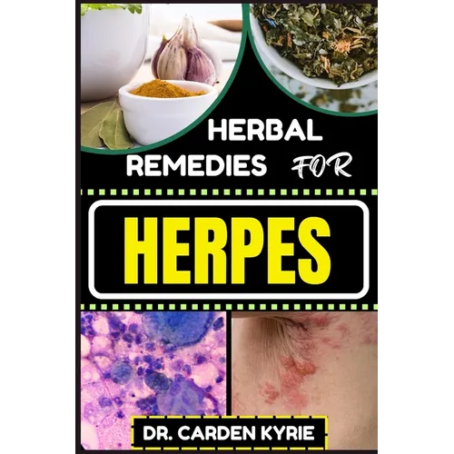 Herbal Remedies for Herpes: Unlocking Nature's Healing Power For Targeting Relief, Holistic Wellness, Immune Support And Integrating Herbs Into Yo