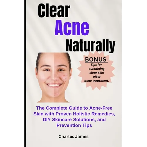 Clear Acne Naturally: The Complete Guide to Acne-Free Skin with Proven Holistic Remedies, DIY Skincare Solutions, and Prevention Tips