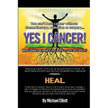 Yes I Cancer: You can't beat cancer without chemotherapy, radiation or surgery