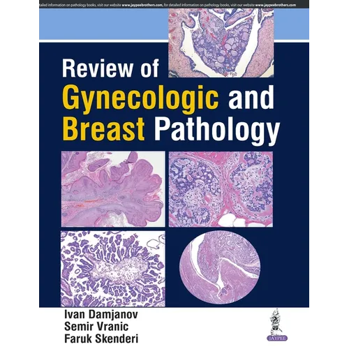 Review of Gynecologic and Breast Pathology