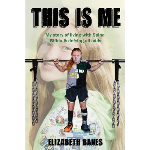This Is Me: My story of living with Spina Bifida & defying all odds
