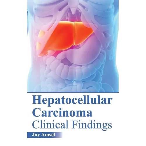 Hepatocellular Carcinoma: Clinical Findings