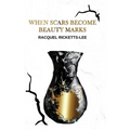 When Scars Become Beauty Marks