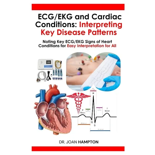 ECG/EKG and Cardiac Conditions: Interpreting Key Disease Patterns: Noting Key ECG/EKG Signs of Heart Conditions for Easy Interpretation for All