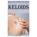 Beginners Guide on Keloids