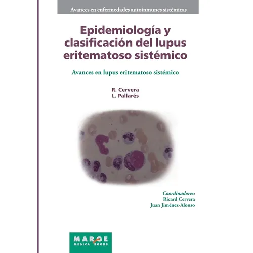 Epidemiología y clasificación del lupus eritematoso sistémico