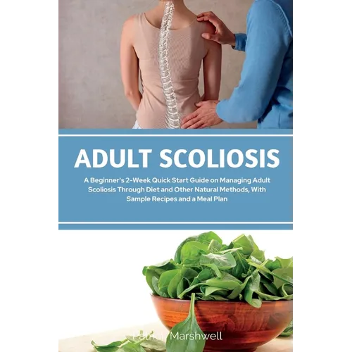 Adult Scoliosis: A Beginner's 2-Week Quick Start Guide on Managing Adult Scoliosis Through Diet and Other Natural Methods, With Sample Recipes and a M