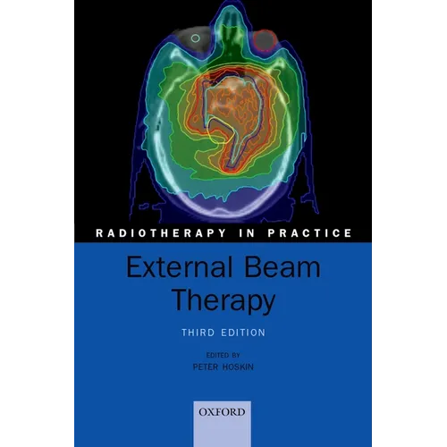 External Beam Therapy