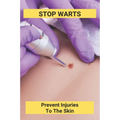 Stop Warts: Prevent Injuries To The Skin: Warts Treatment Near Me