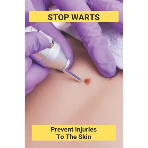 Stop Warts: Prevent Injuries To The Skin: Warts Treatment Near Me