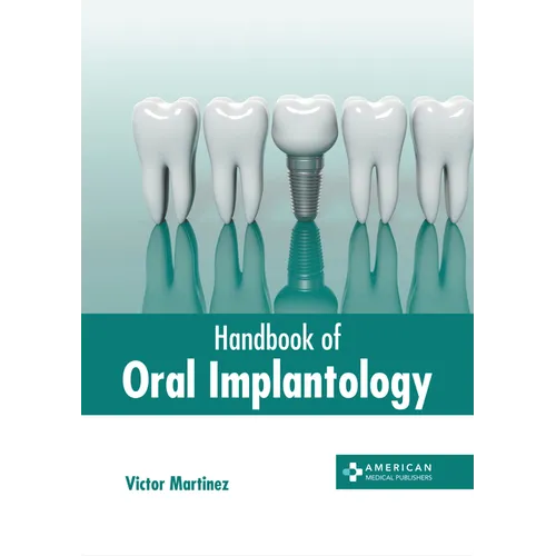 Handbook of Oral Implantology