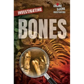 Investigating Bones