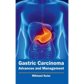 Gastric Carcinoma: Advances and Management