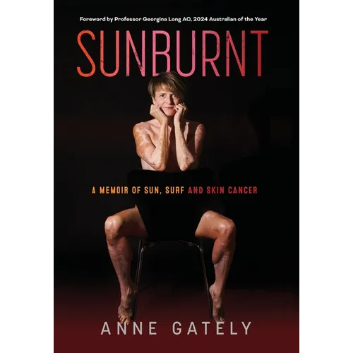 Sunburnt: A memoir of sun, surf and skin cancer