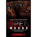 Open Wound 1