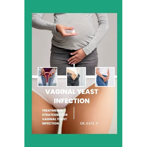 Vaginal Yeast Infection: Treatments Strategies for Vaginal Yeast Infection