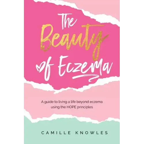 The Beauty of Eczema: A Guide To Living a Life Beyond Eczema Using The Hope Principles