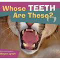 Whose Teeth Are These?