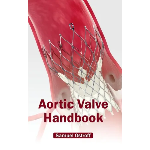 Aortic Valve Handbook