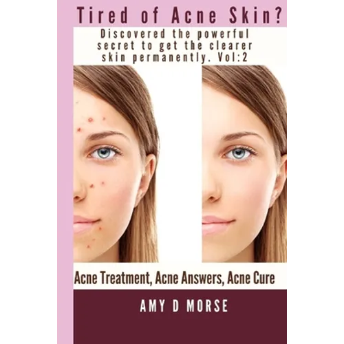 TIRED OF ACNE SKIN? Discover the Powerful Secrets to get Clearer Skin Permanently