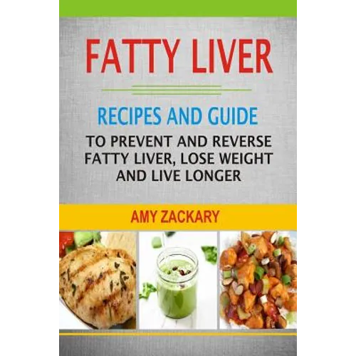 Fatty Liver: Recipes And Guide To Prevent And Reverse Fatty Liver, Lose Weight And Live Longer