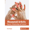 Rheumatoid Arthritis: Diagnosis, Pathophysiology and Treatment