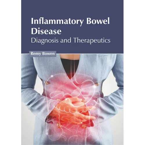 Inflammatory Bowel Disease: Diagnosis and Therapeutics