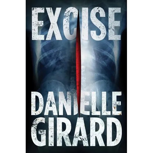 Excise
