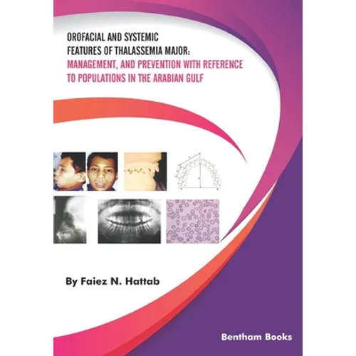 Orofacial and Systemic Features of Thalassemia Major: Management, and Prevention with Reference to Populations in the Arabian Gulf