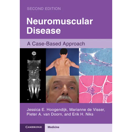 Neuromuscular Disease: A Case-Based Approach