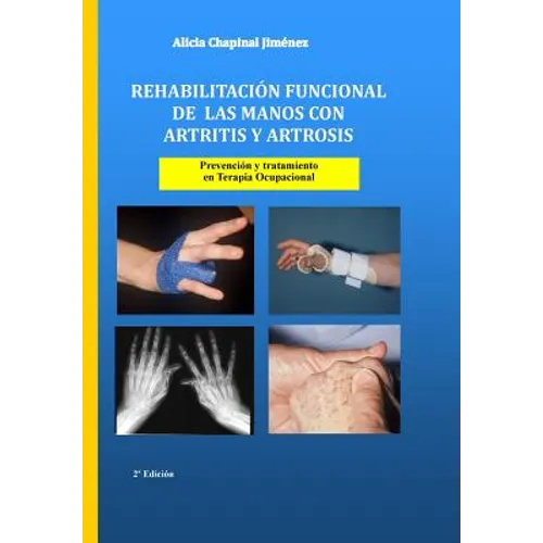 Rehabilitación funcional de las manos con artritis y artrosis: Prevención y tratamiento