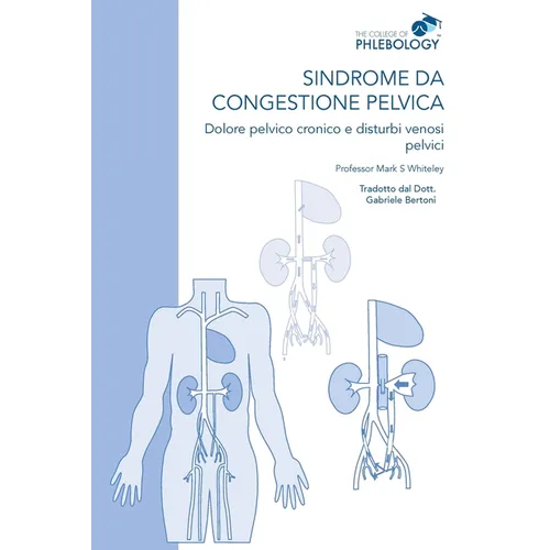 Sindrome da congestione pelvica - Dolore pelvico cronico e disturbi venosi pelvici