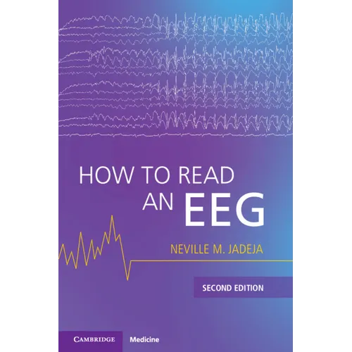 How to Read an Eeg