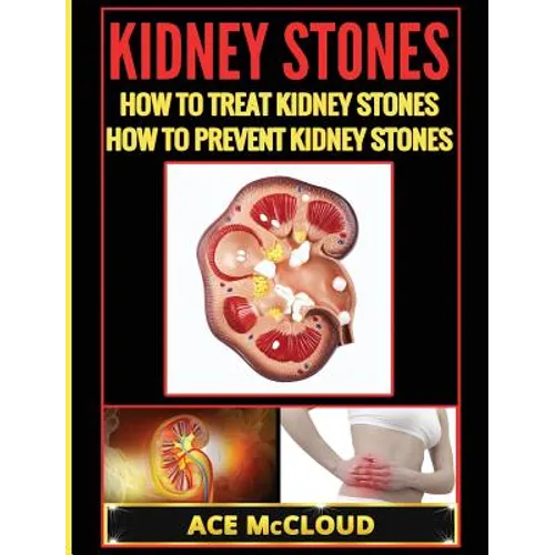 Kidney Stones: How To Treat Kidney Stones: How To Prevent Kidney Stones