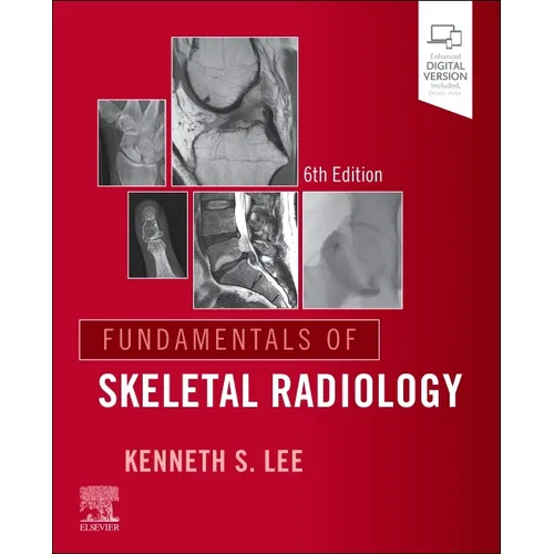 Fundamentals of Skeletal Radiology