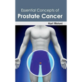 Essential Concepts of Prostate Cancer
