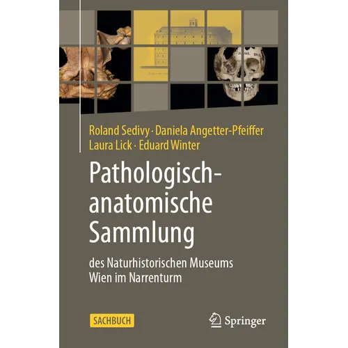 Pathologisch-Anatomische Sammlung Des Naturhistorischen Museums Wien Im Narrenturm