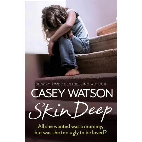 Skin Deep: All she wanted was a mummy, but was she too ugly to be loved?