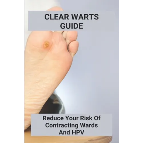Clear Warts Guide: Reduce Your Risk Of Contracting Wards And Hpv: Does Duct Tape Get Rid Of Warts - Paperback