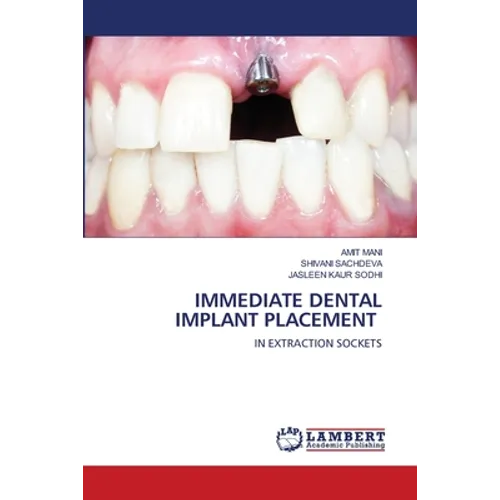 Immediate Dental Implant Placement
