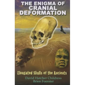 The Enigma of Cranial Deformation: Elongated Skulls of the Ancients