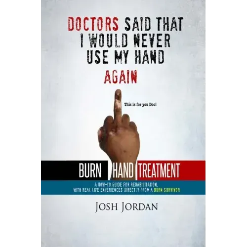 Burn Hand Treatment: A How-To Guide for Rehabilitation with Real Life Experiences from a Burn Survivor