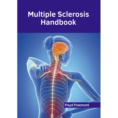 Multiple Sclerosis Handbook