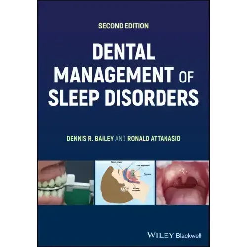 Dental Management of Sleep Disorders